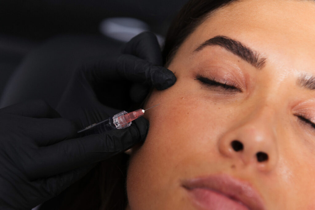 Advantages Of Profhilo Structura Treatment