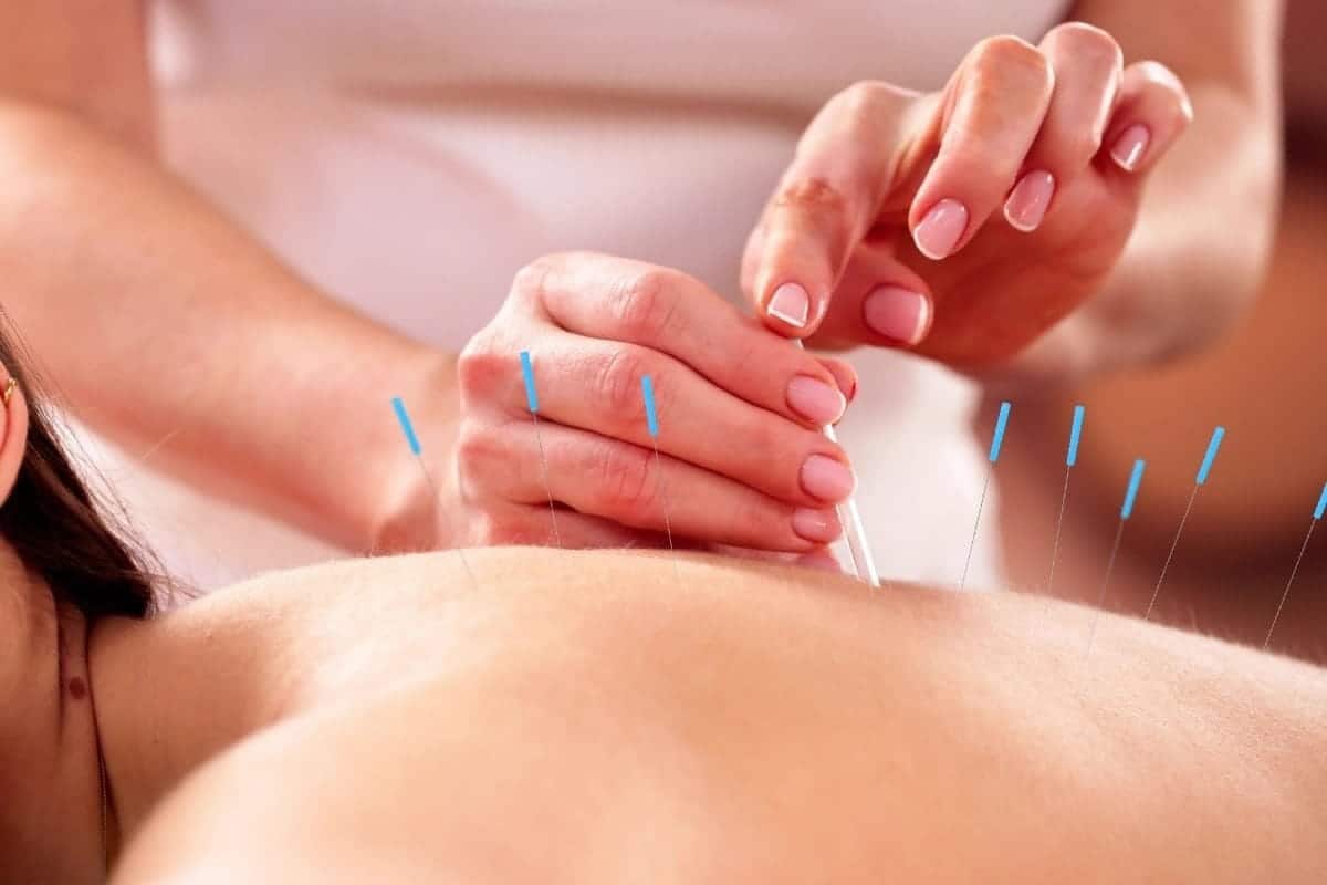 Expert Acupuncture Services – An Introduction